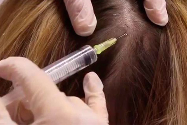 MEZOTERAPİNİN ETKİSİ VE FAYDALARI