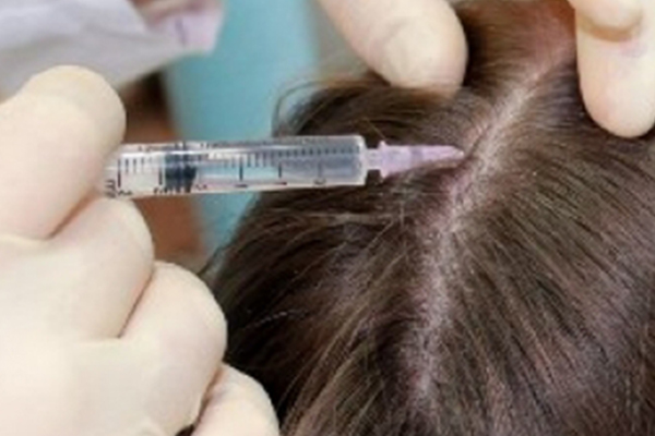 MEZOTERAPI-KIMLERE-UYGULANAMAZ-